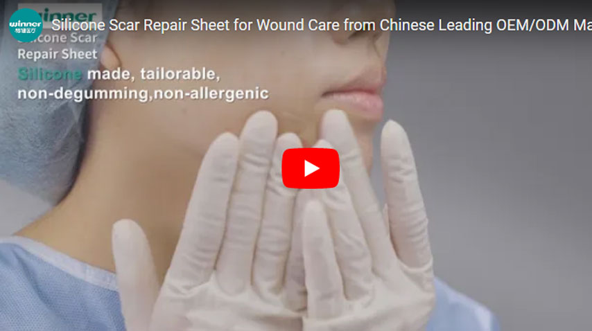 中国の大手oem / odmメーカーから創傷ケアのためのシリコーン傷跡修復シート